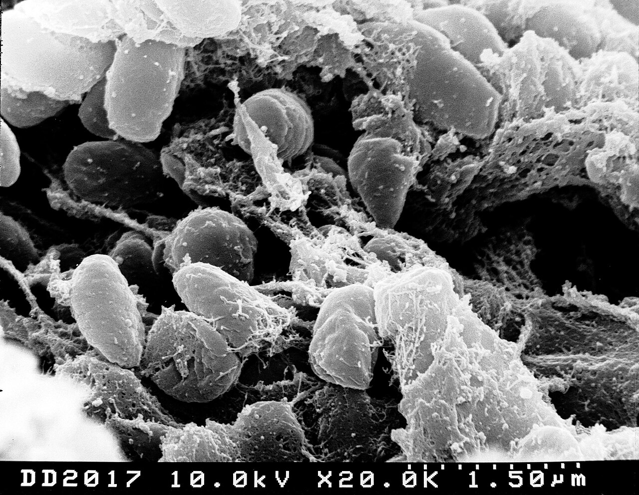 The plague never went away: where cases still occur