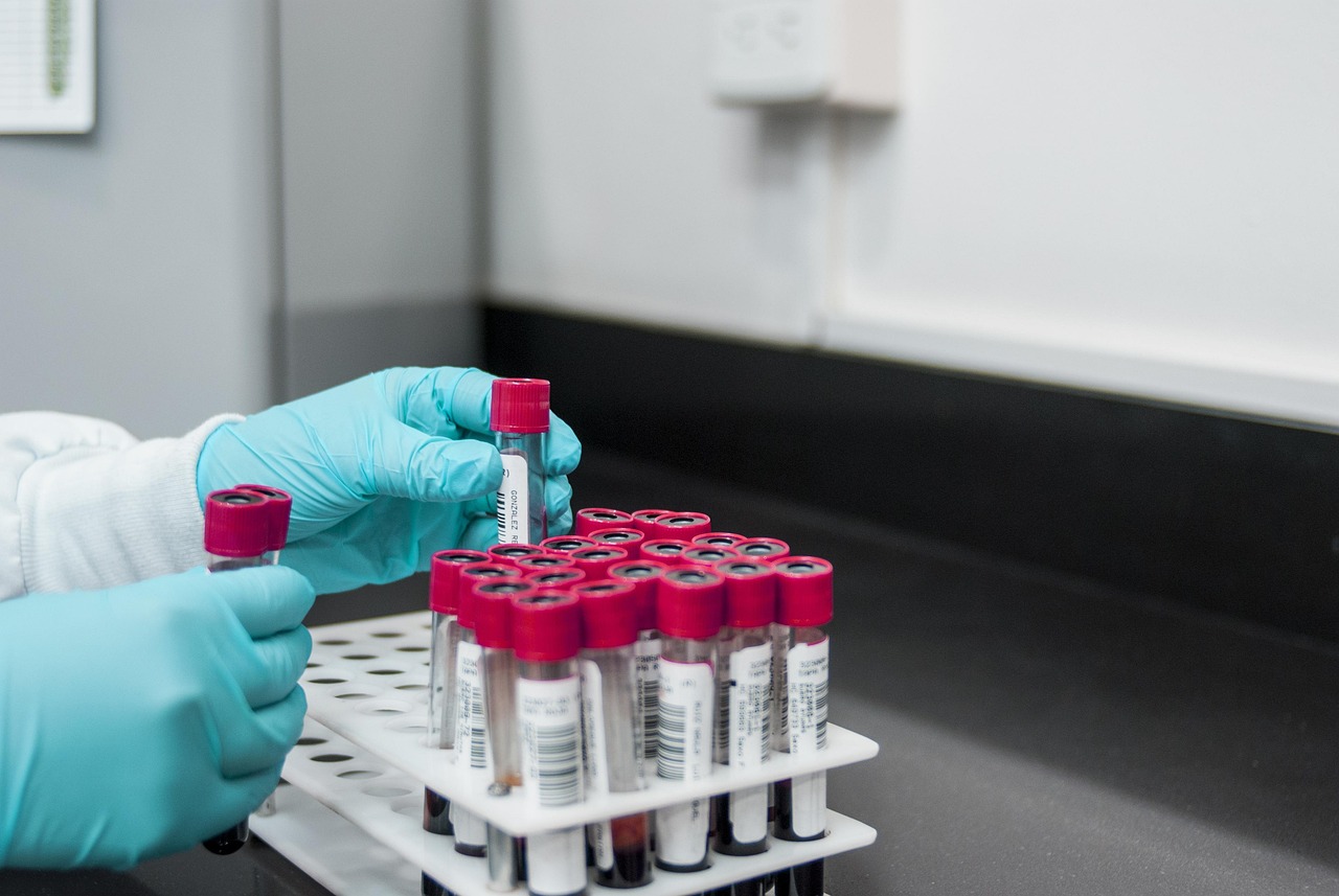 Gloved hands placing blood sample tubes with red caps into a rack on a laboratory bench