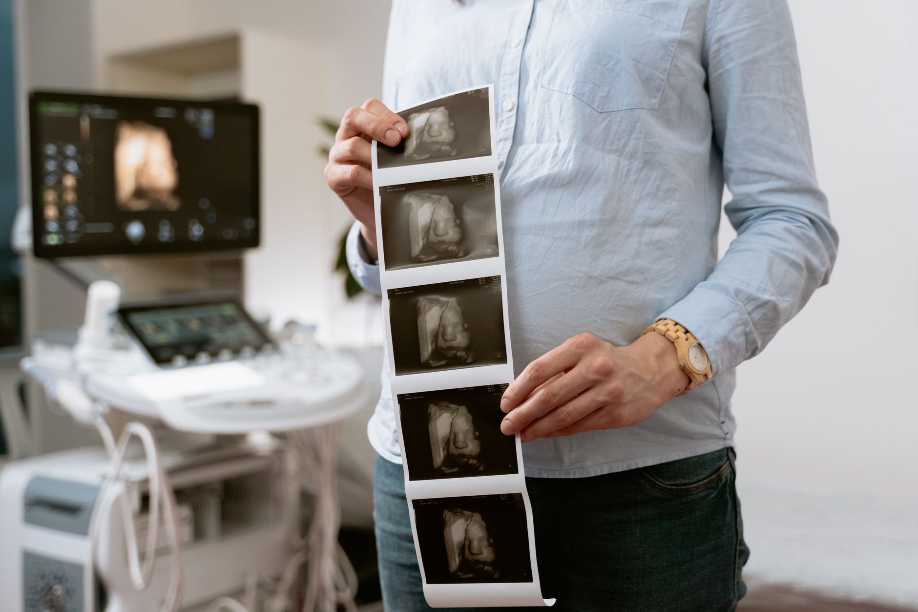 Person in a blue shirt holding a strip of 3D ultrasound printouts in front of an ultrasound machine in a clinic room.