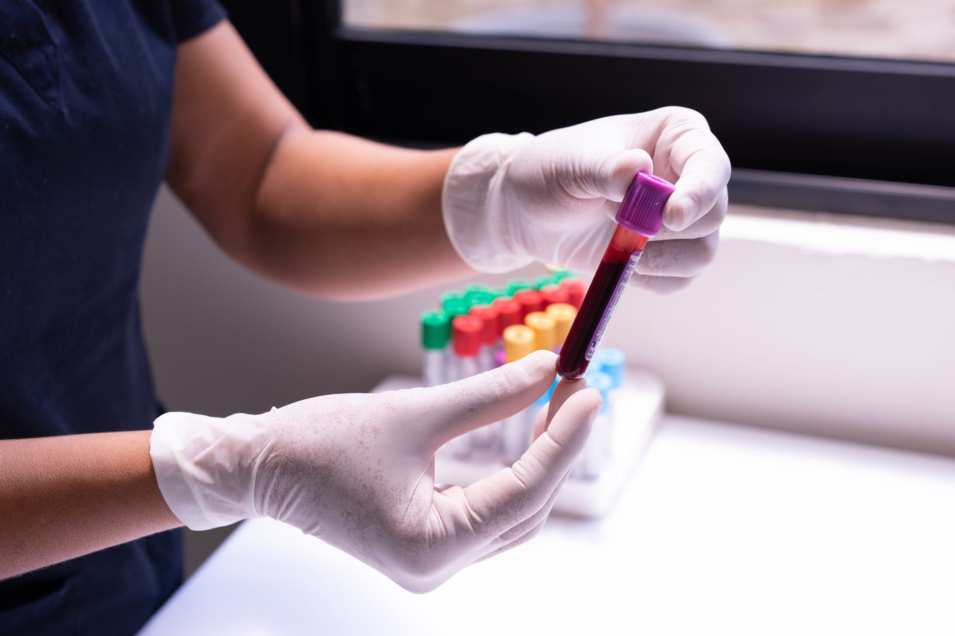 A person wearing white latex gloves holds a blood sample tube in front of a rack of test tubes.